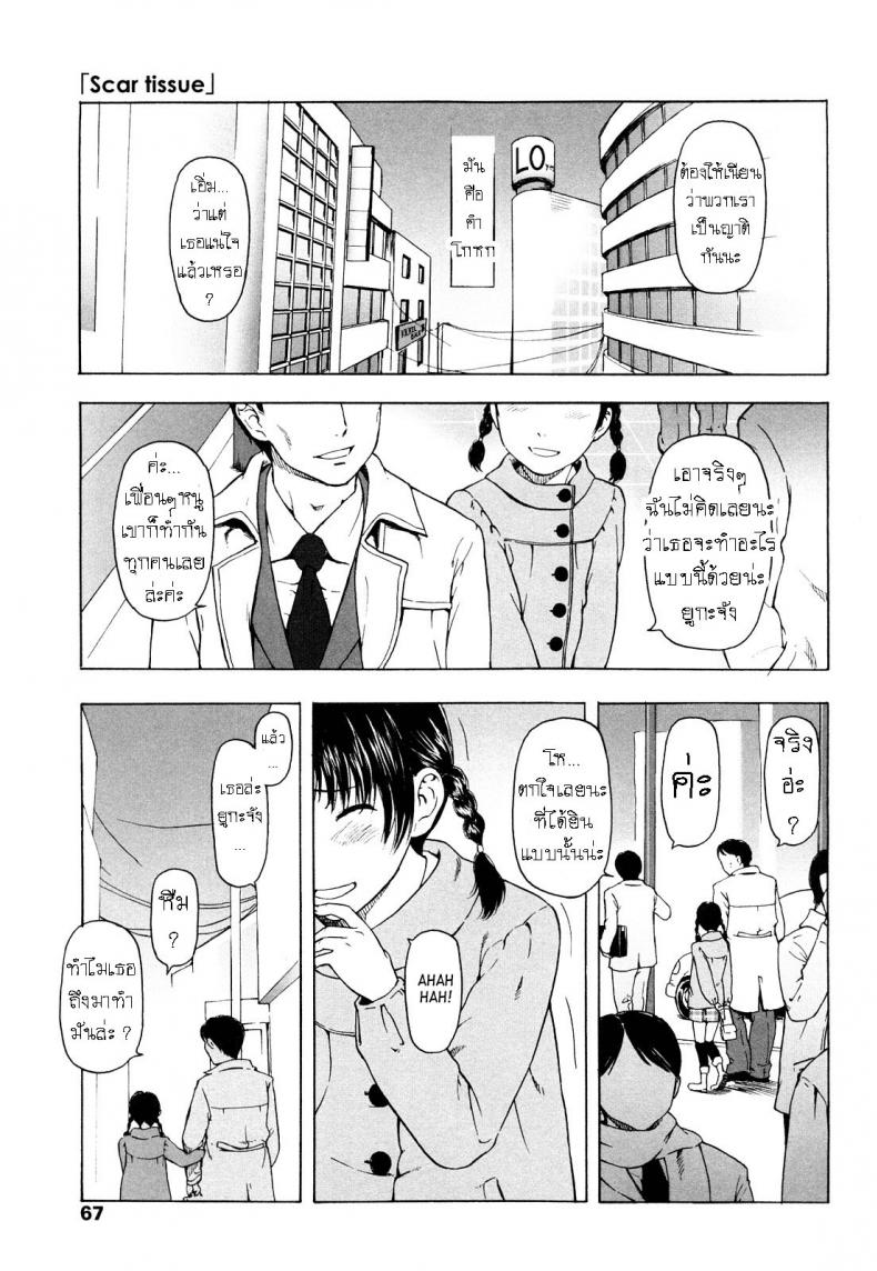 รอยแผลในใจ [Onizuka Naoshi] Scar Tissue